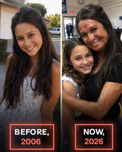 My Daughter Told Me to Stay Away from Her School Because of My Burn Scars – Then a Stranger Entered Her Auditorium and Said, “Your Mother Has Been Hiding the Truth for 20 Years”